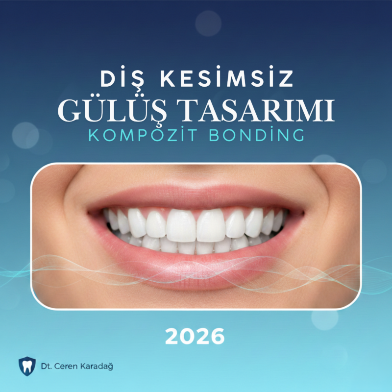 Diş kesimsiz gülüş tasarımı kompozit bonding