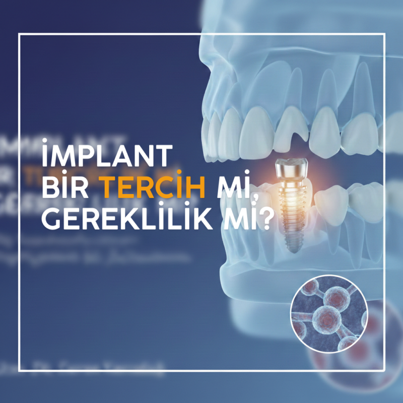 İmplant Bir Tercih mi, Gereklilik mi