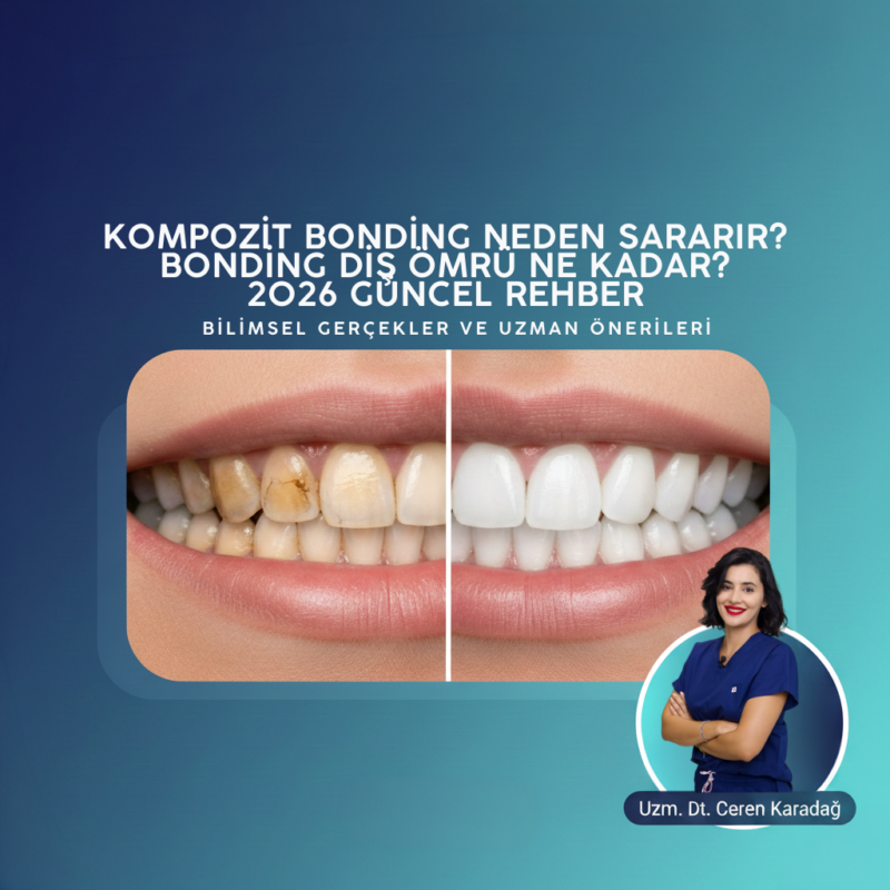 Kompozit Bonding Neden Sararır