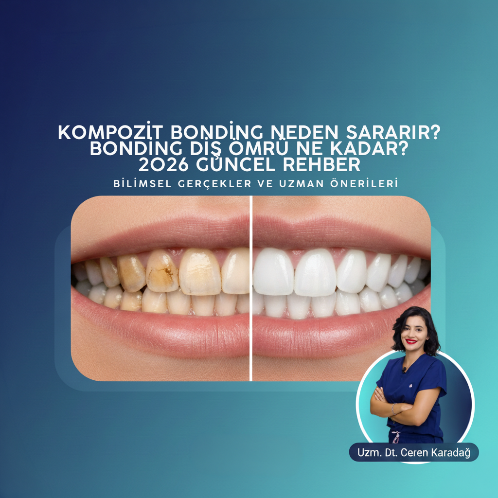 Kompozit Bonding Neden Sararır