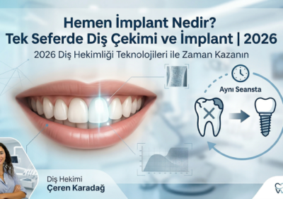Hemen İmplant Nedir Tek Seferde Diş Çekimi ve İmplant