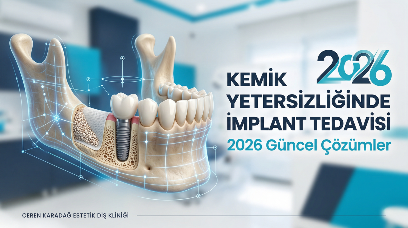Kemik Yetersizse İmplant Yapılır mı