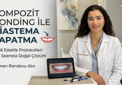 Kompozit Bonding ile Diastema Kapatma Nasıl Yapılır