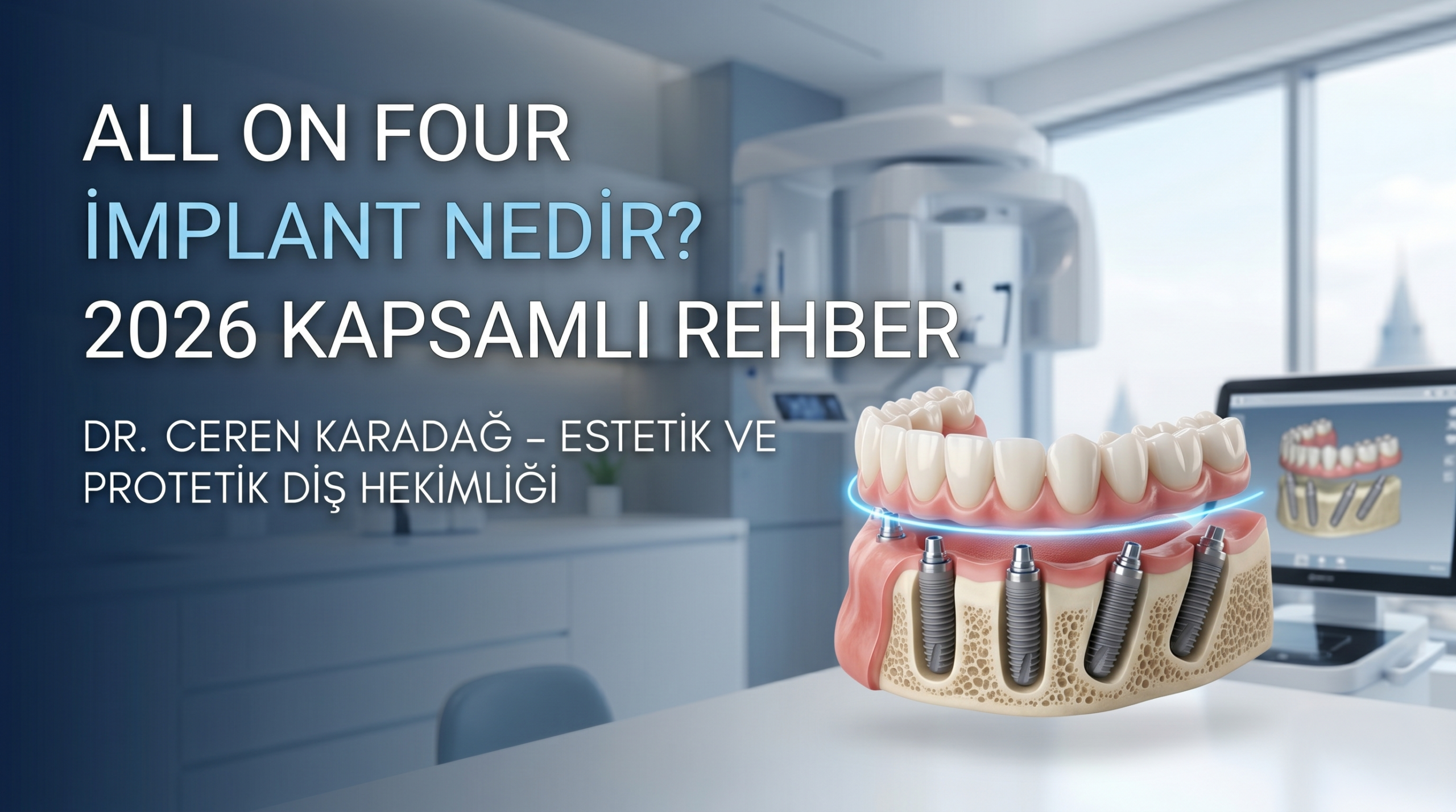 All on Four İmplant Nedir