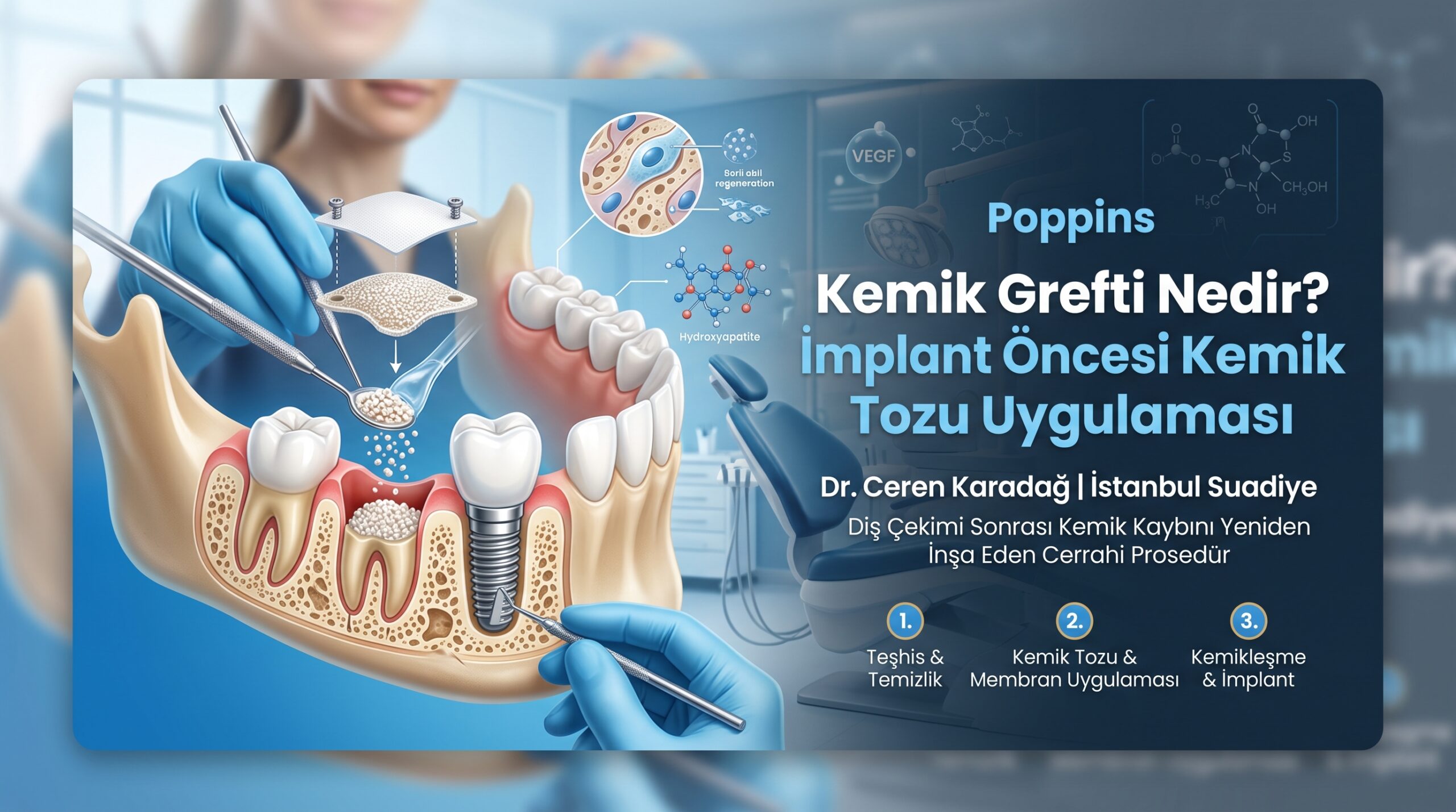Kemik Grefti Nedir? İmplant Öncesi Kemik Tozu Uygulaması Kemik Grefti Nedir İmplant Öncesi Kemik Tozu Uygulaması